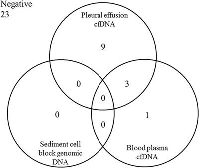 Cell-free DNA From Pleural Effusion Samples: Is It Right for Molecular Testing in Lung Adenocarcinoma?